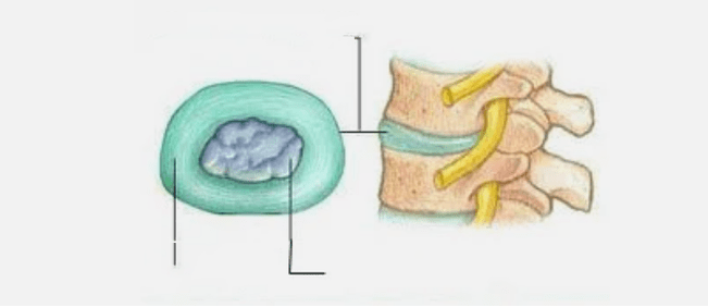 Osteochondrozės pobūdis