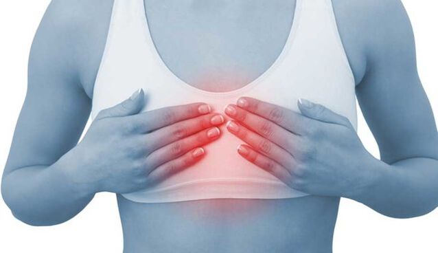 Skausmas krūtinkaulio priekyje yra krūtinės ląstos stuburo osteochondrozės požymis